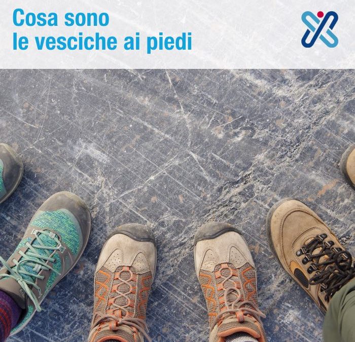 vesciche ai piedi corsa trekking