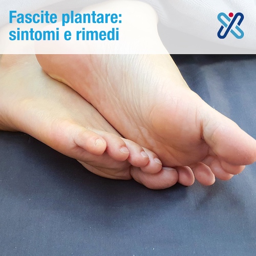 Fascite Plantare Sintomi Rimedi E Caso Clinico I Sport Clinic