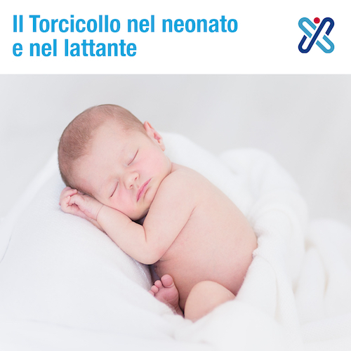 torcicollo neonato