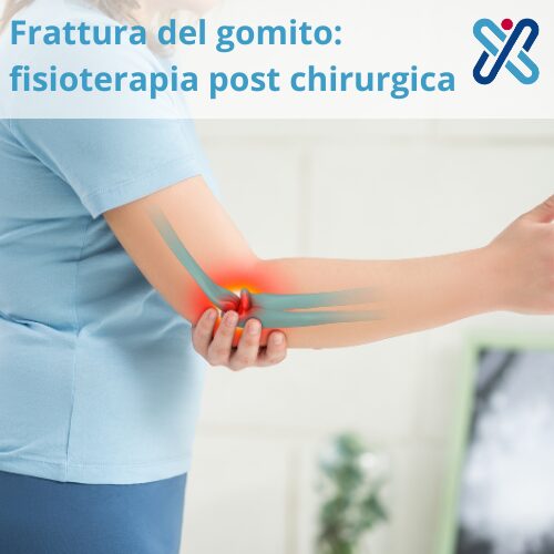 frattura gomito fisioterapia