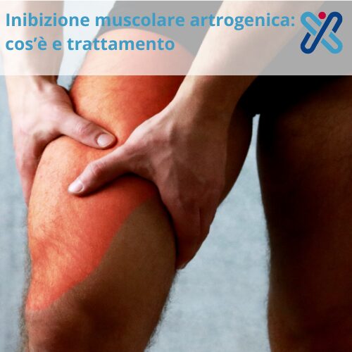 inibizione muscolare artrogenica